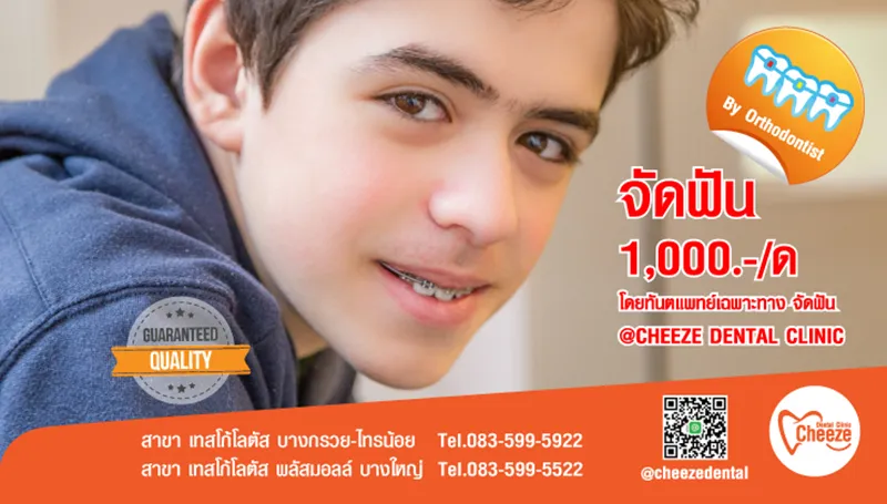 โปรจัดฟันชาย-63-1