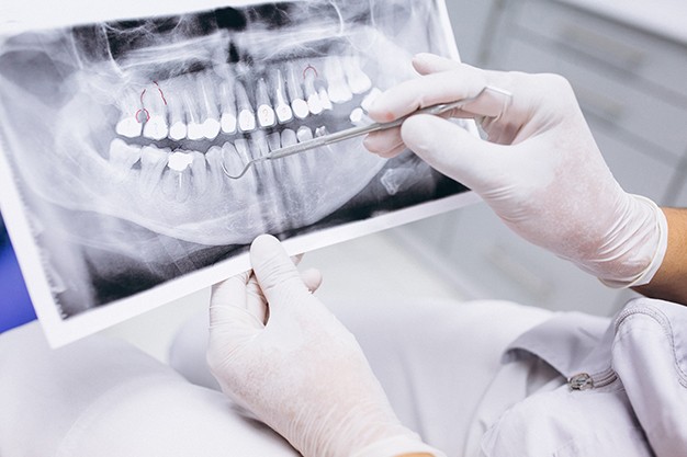 2-x-ray