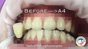 1รีวิว