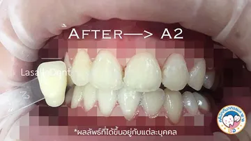 2รีวิว