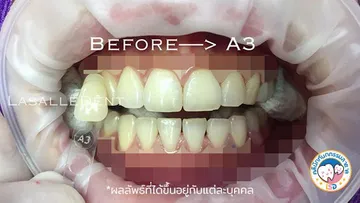 3รีวิว