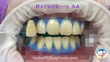 5รีวิว
