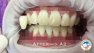 6รีวิว