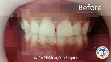 รีวิว1