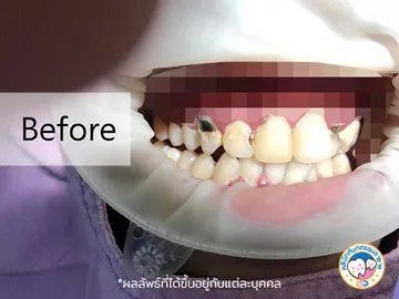 รีวิว1