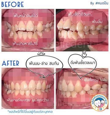รีวิว2