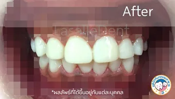 รีวิว2