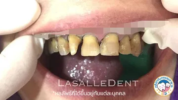 รีวิว3