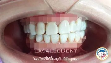 รีวิว4
