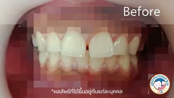 รีวิว5