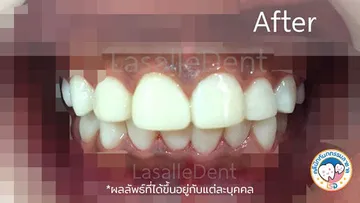 รีวิว6