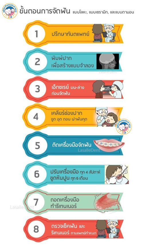 ขั้นตอนการจัดฟัน-11367573832738