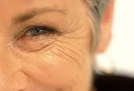 face-lift3
