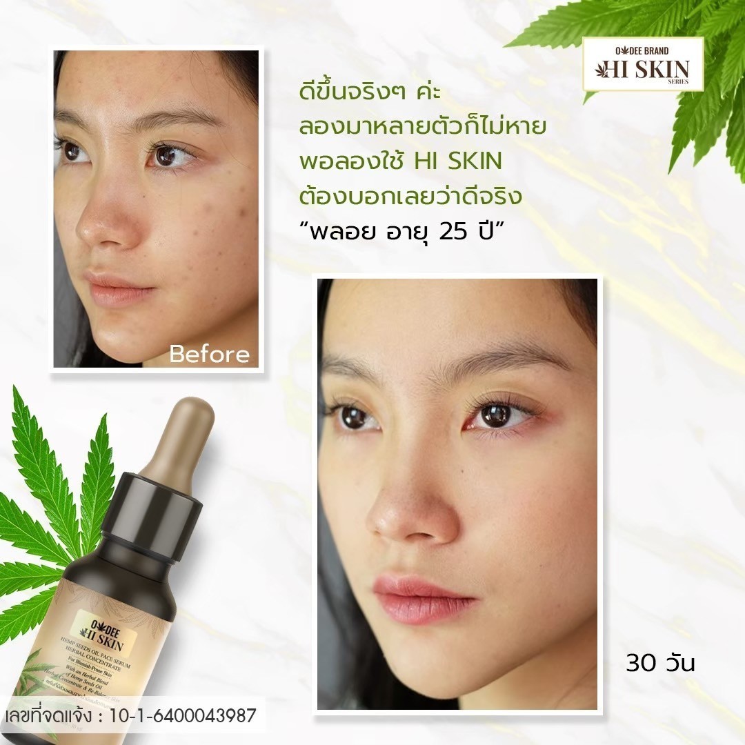 เซรั่มกัญชา