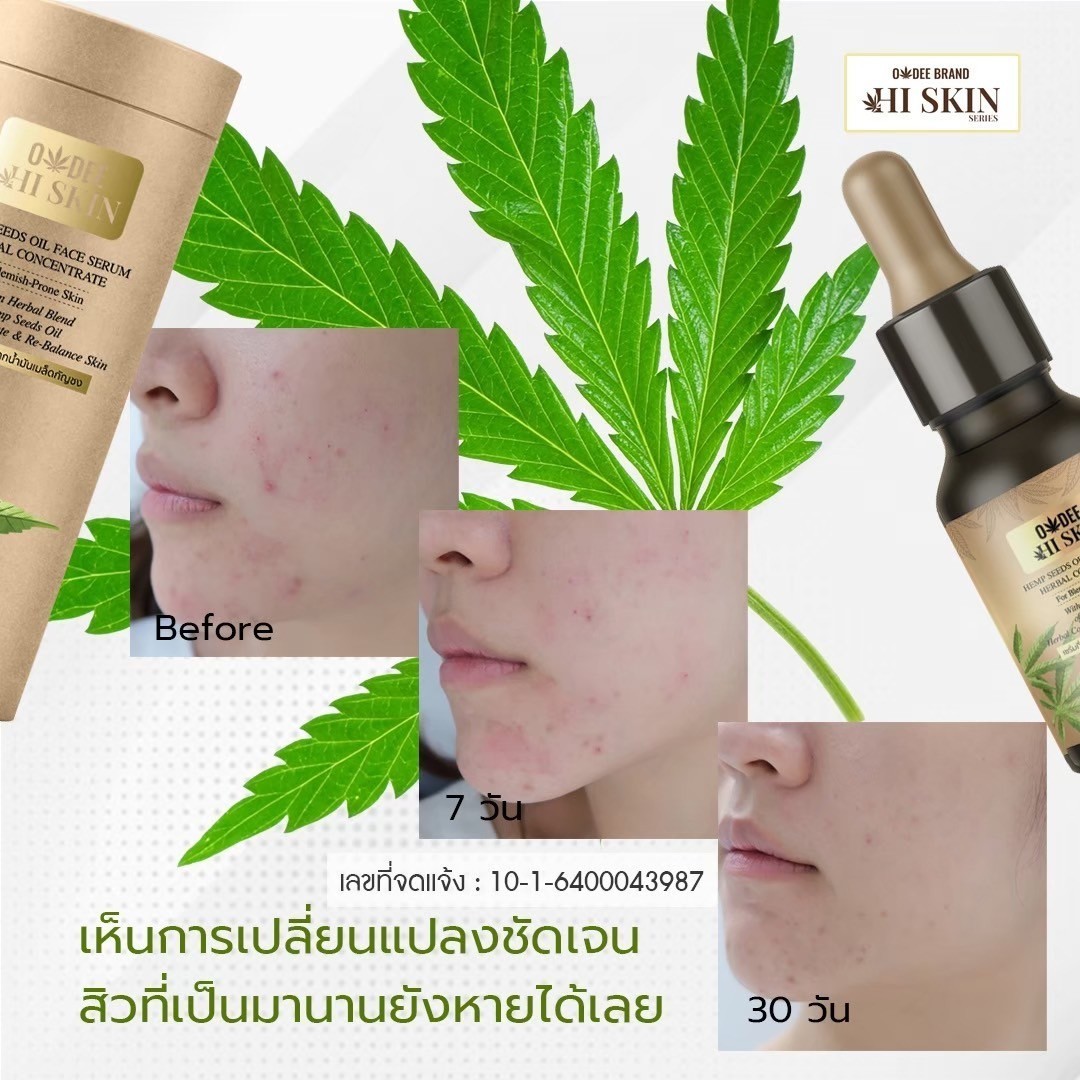 เซรั่มกัญชา