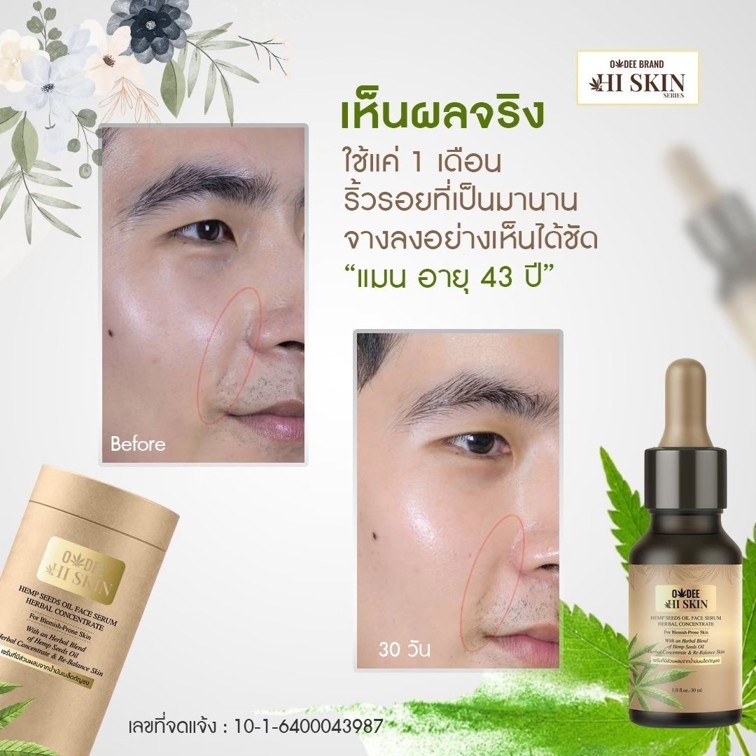เซรั่มกัญชา