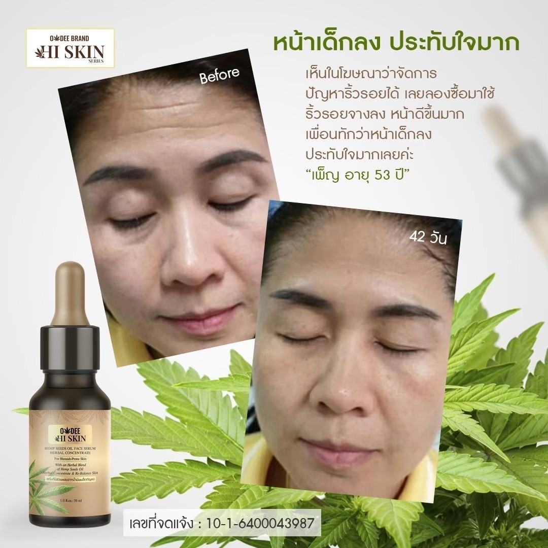 เซรั่มกัญชา