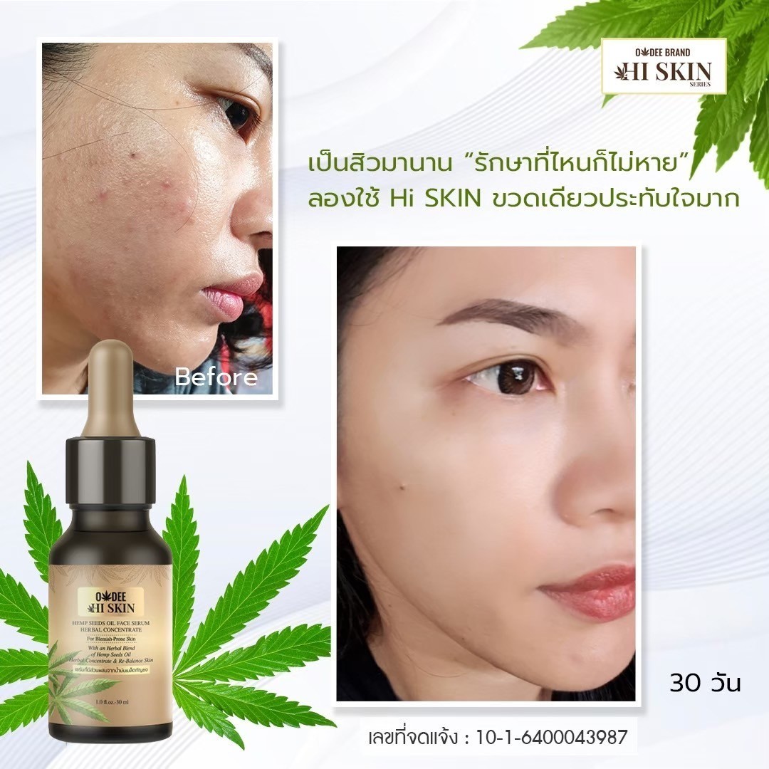 เซรั่มกัญชา