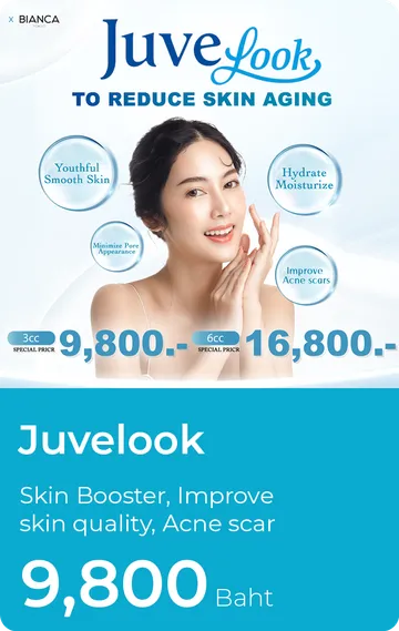 Juvelook