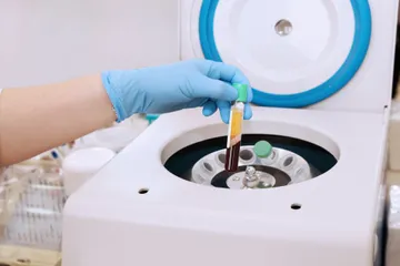 PRP(2)