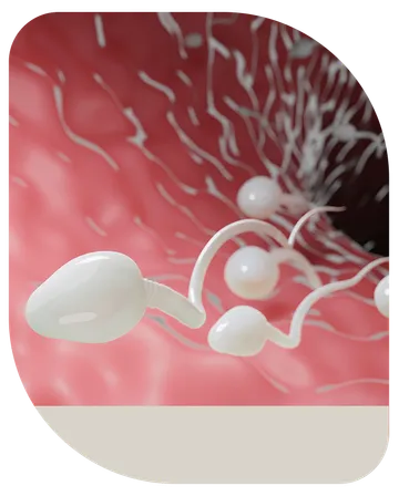 IUI-2