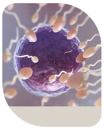 IVF