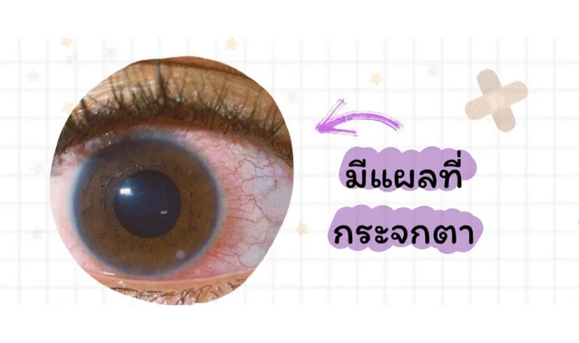 keeplookbyoptometrists2