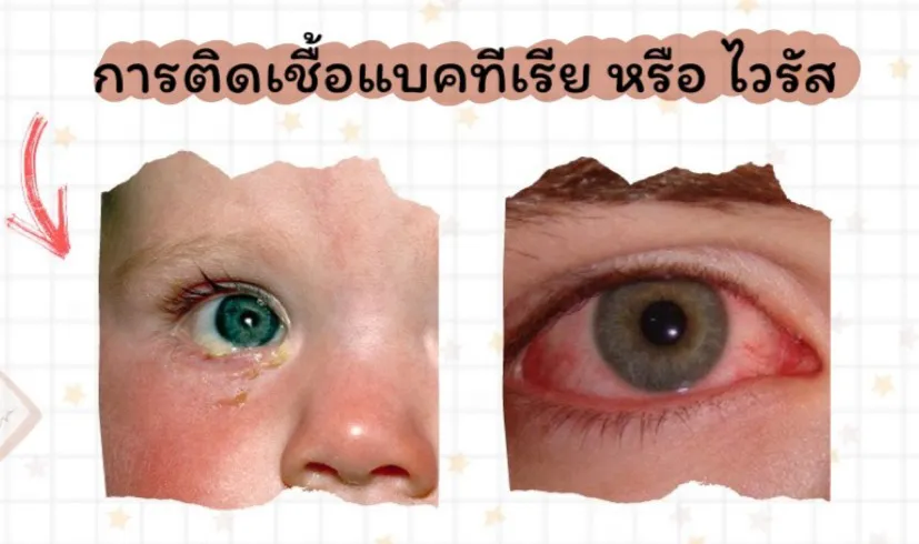 keeplookbyoptometrists3
