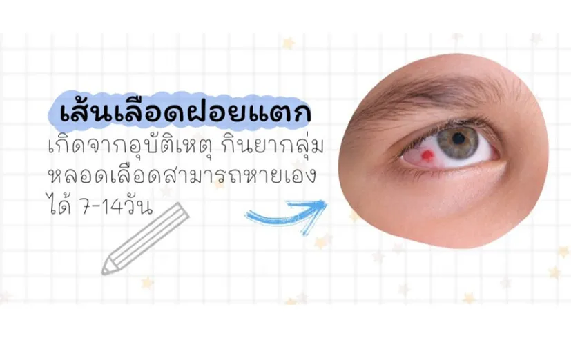 keeplookbyoptometrists4