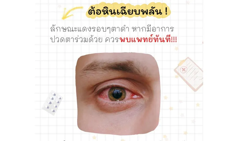 keeplookbyoptometrists6