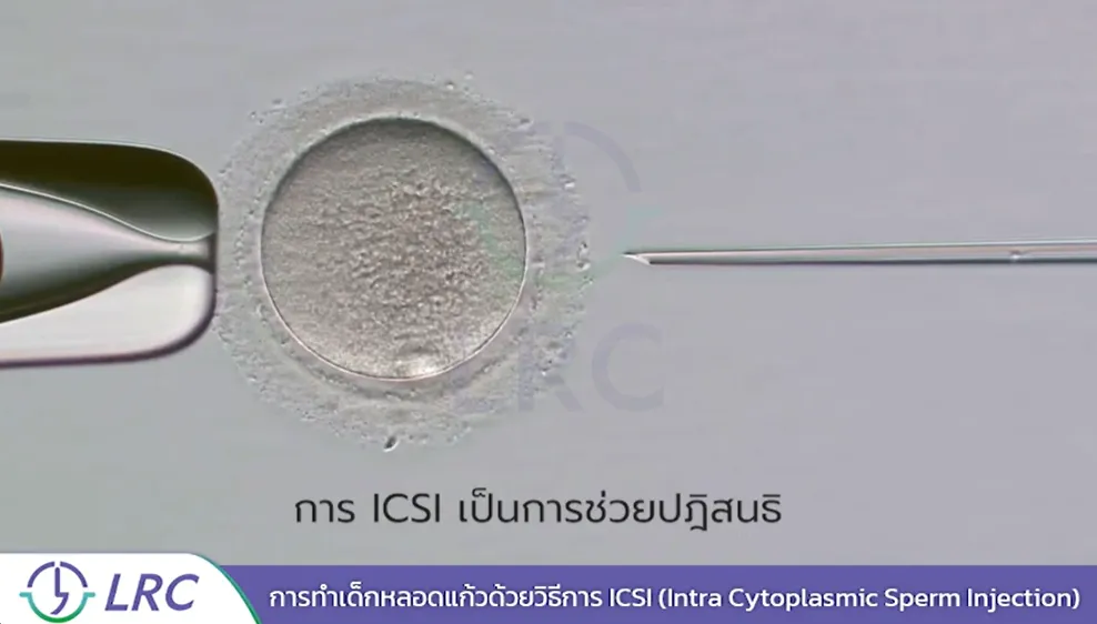 WhatisIcsi