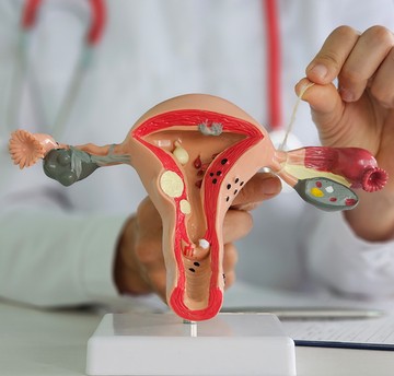 IUI
