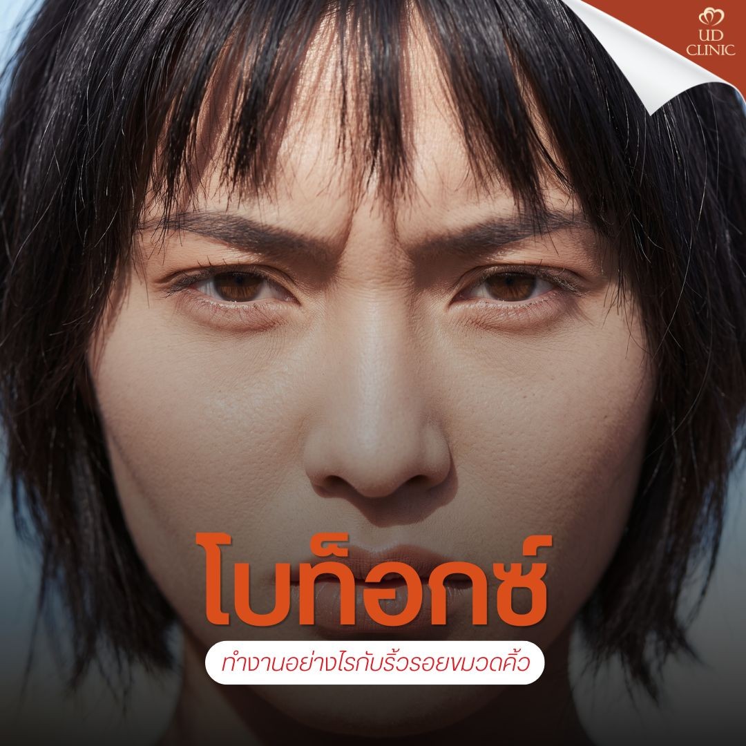 1.2 UD _ ติดซีรีส์ยันตีสองจนติดนิสัย _ขมวดคิ้ว_ รู้ตัวอีกทีริ้วรอยลึก โบท็อกซ์กู้หน้าเครียดทันไหม_