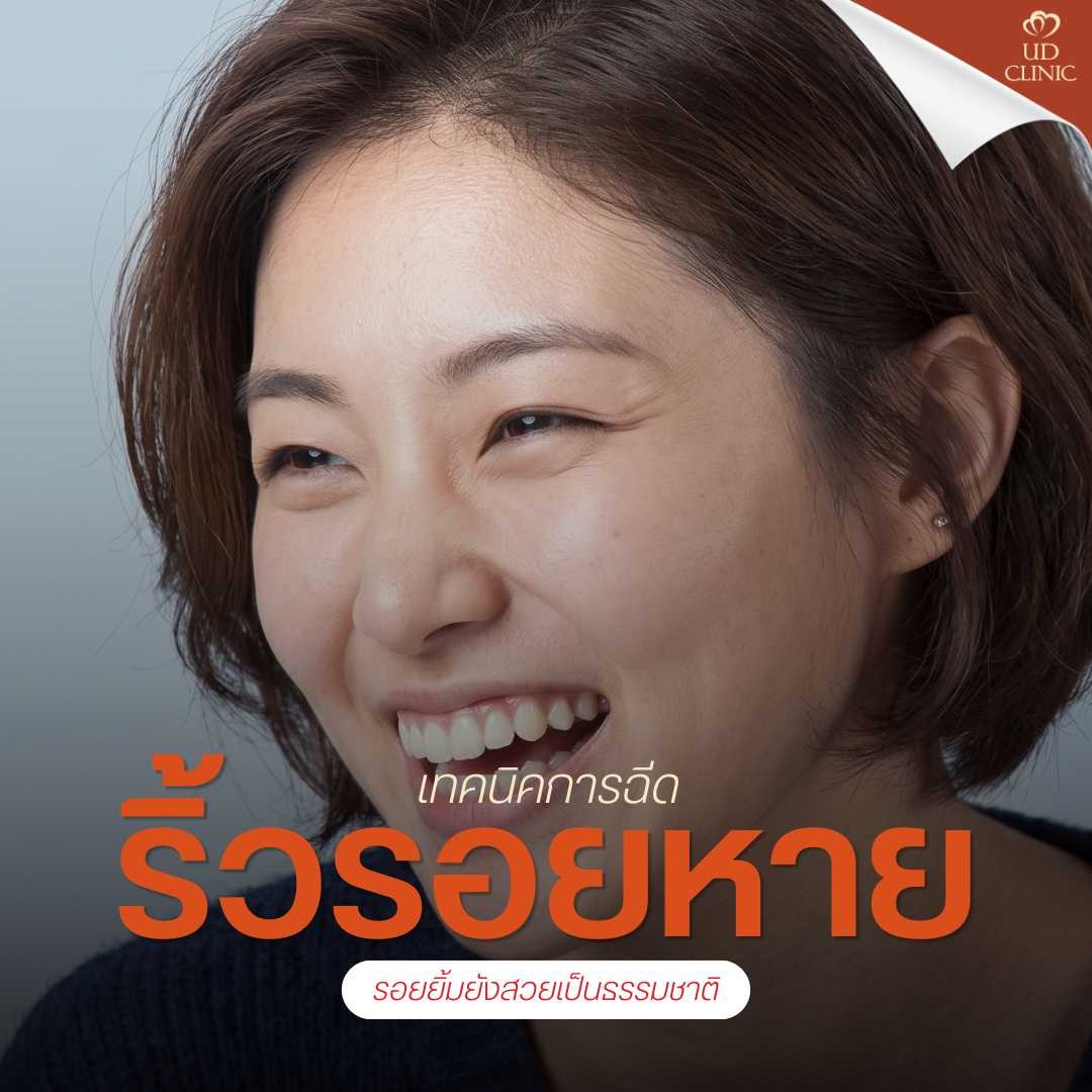 41.2 UD _ หัวเราะทีไรตีนกามาเต็ม ฉีดโบท็อกซ์หางตาและรอบดวงตาอย่างไร ให้ริ้วรอยหายแต่ยังยิ้มสวย ตาไม่แข็งเป็นหุ่นยนต์