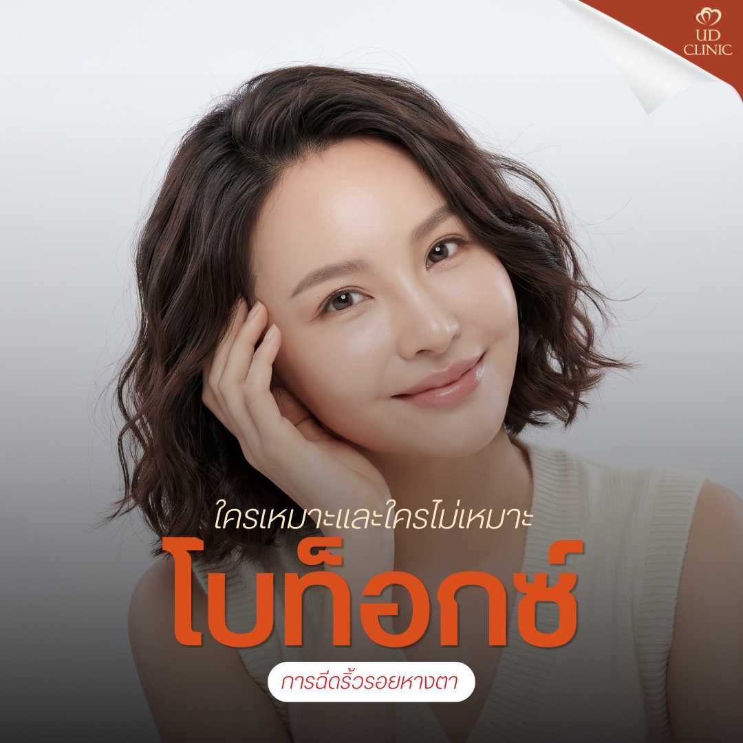 41.3 UD _ หัวเราะทีไรตีนกามาเต็ม ฉีดโบท็อกซ์หางตาและรอบดวงตาอย่างไร ให้ริ้วรอยหายแต่ยังยิ้มสวย ตาไม่แข็งเป็นหุ่นยนต์