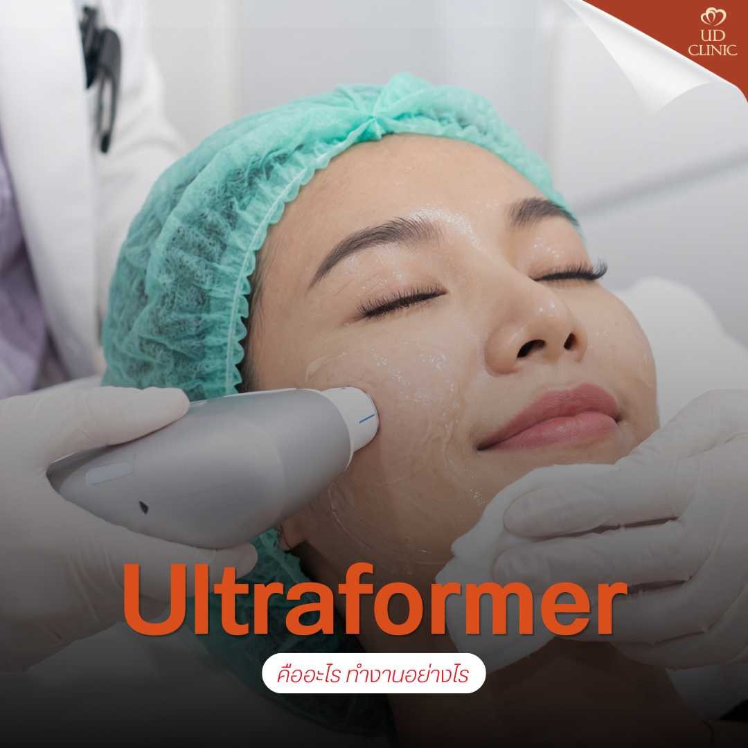 45.2 UD _ เหนียงโผล่ตอนเปิดกล้องประชุม Zoom แก้ไขด้วย Ultraformer กี่วันเห็นกรอบหน้าชัด_