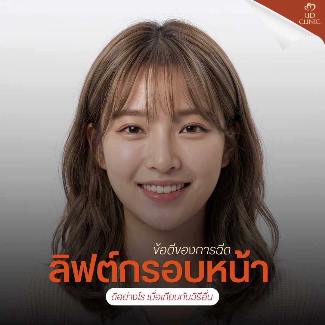 46.3 UD _ ฉีดโบท็อกซ์ลิฟท์กรอบหน้า หน้าเรียวชัดเจนขึ้นจริงไหม หรือแค่กระชับชั่วคราว_