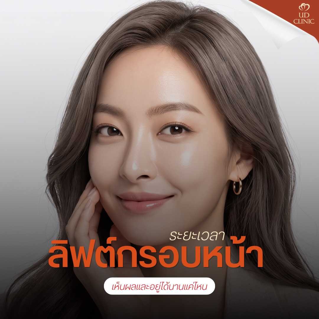 46.2 UD _ ฉีดโบท็อกซ์ลิฟท์กรอบหน้า หน้าเรียวชัดเจนขึ้นจริงไหม หรือแค่กระชับชั่วคราว_