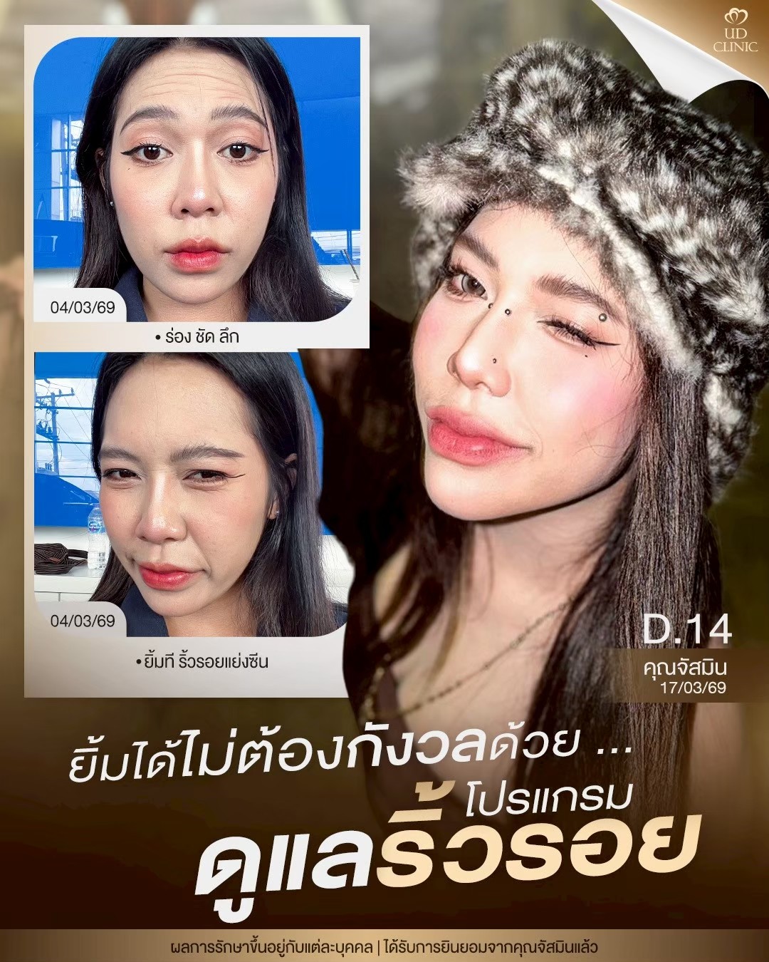 LINE_ALBUM_Skin UD Clinic 2_260807_1