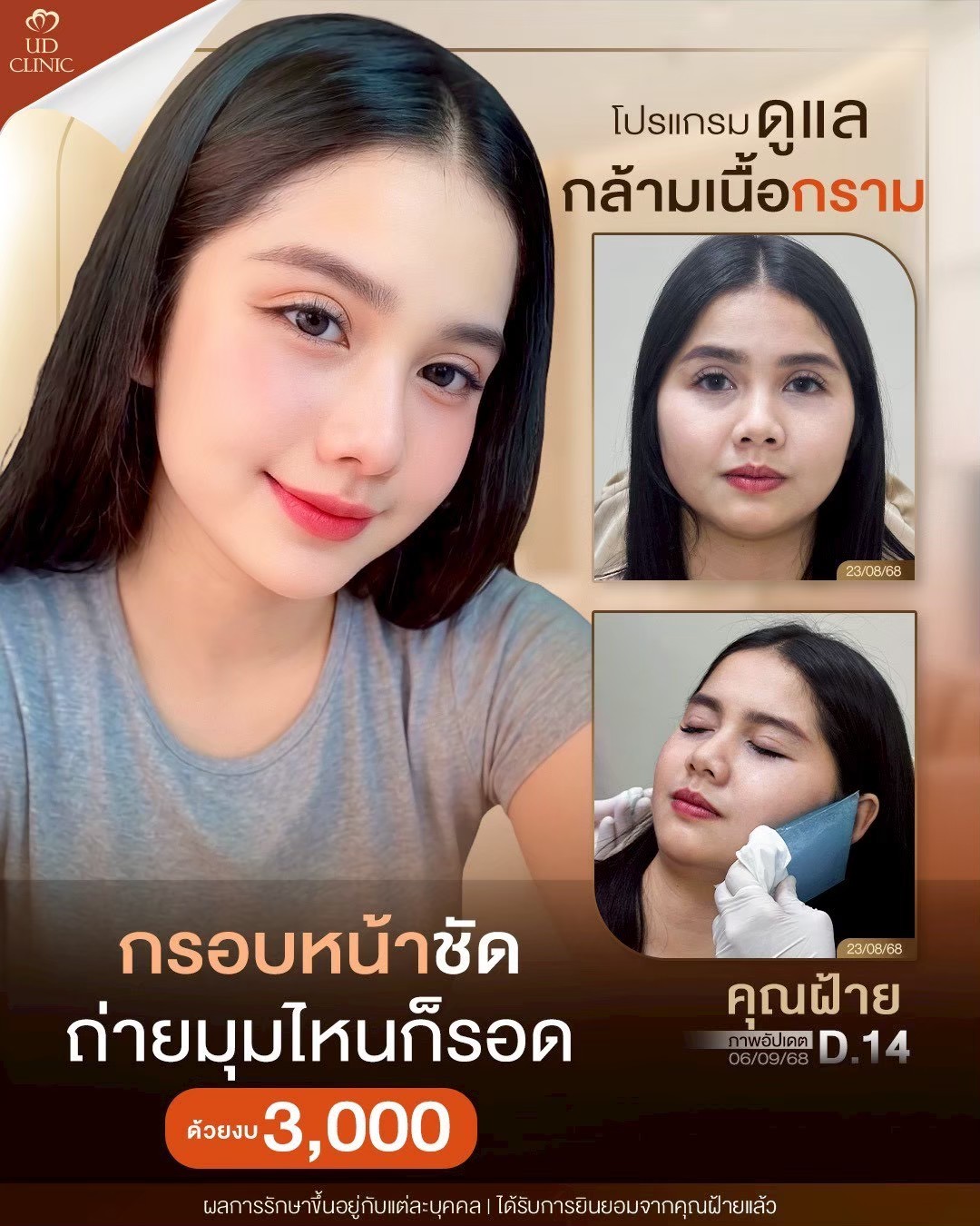 LINE_ALBUM_Skin UD Clinic 2_260904_1