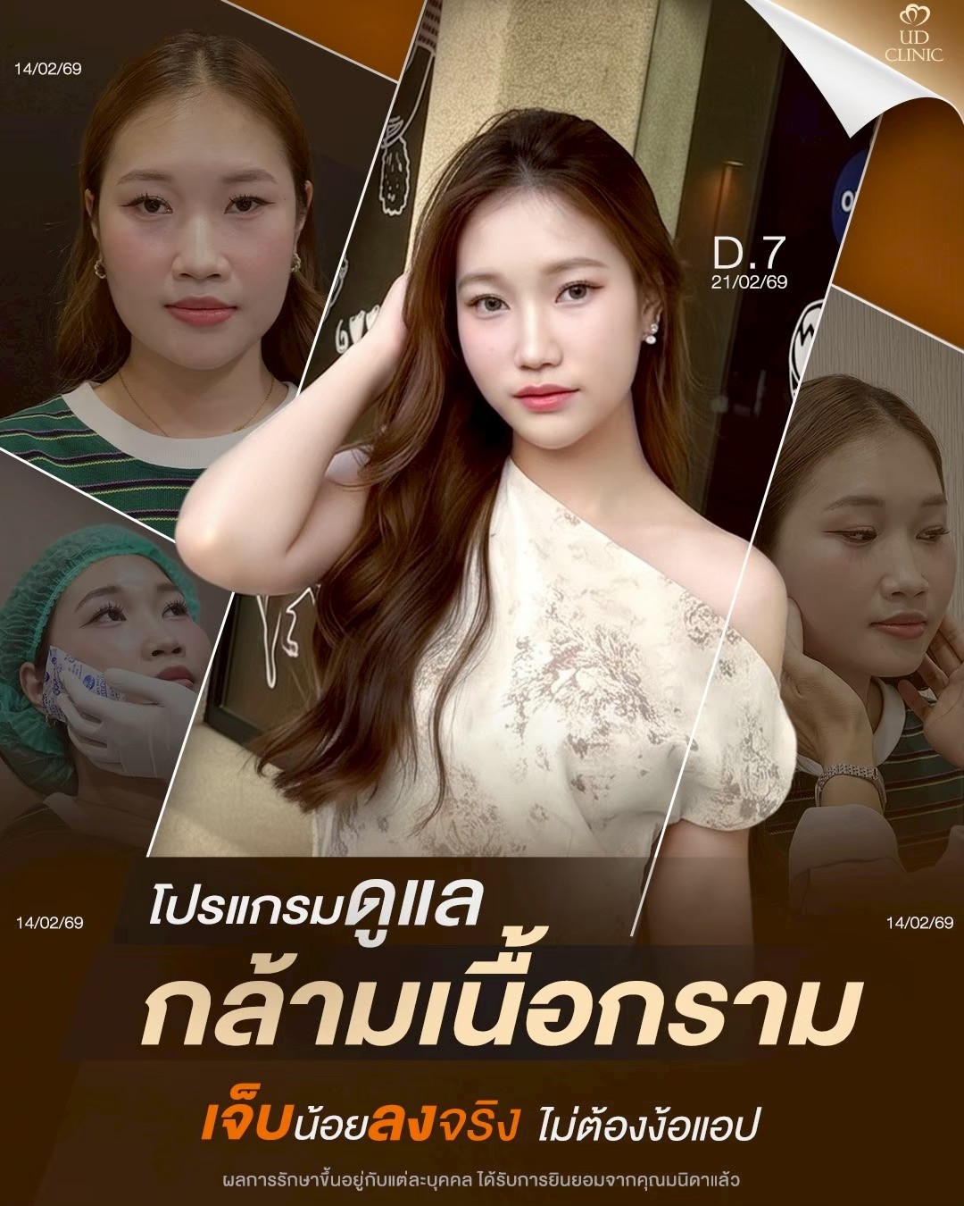 LINE_ALBUM_Skin UD Clinic 2_260904_2
