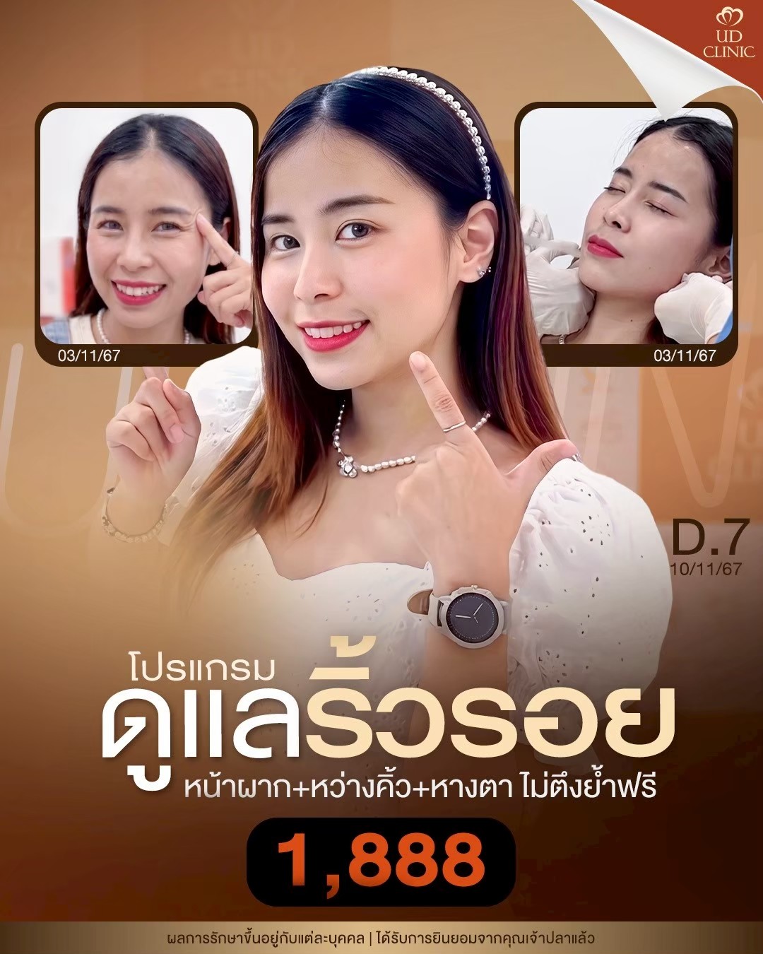 LINE_ALBUM_Skin UD Clinic 2_260909_2