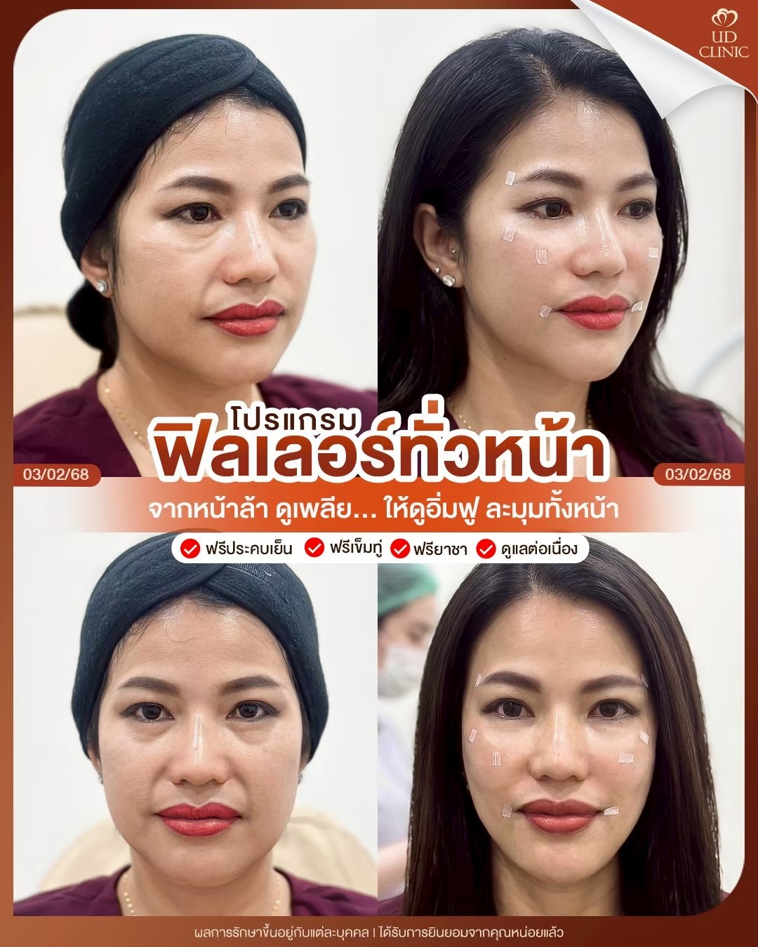 LINE_ALBUM_Skin UD Clinic 2_260910_2