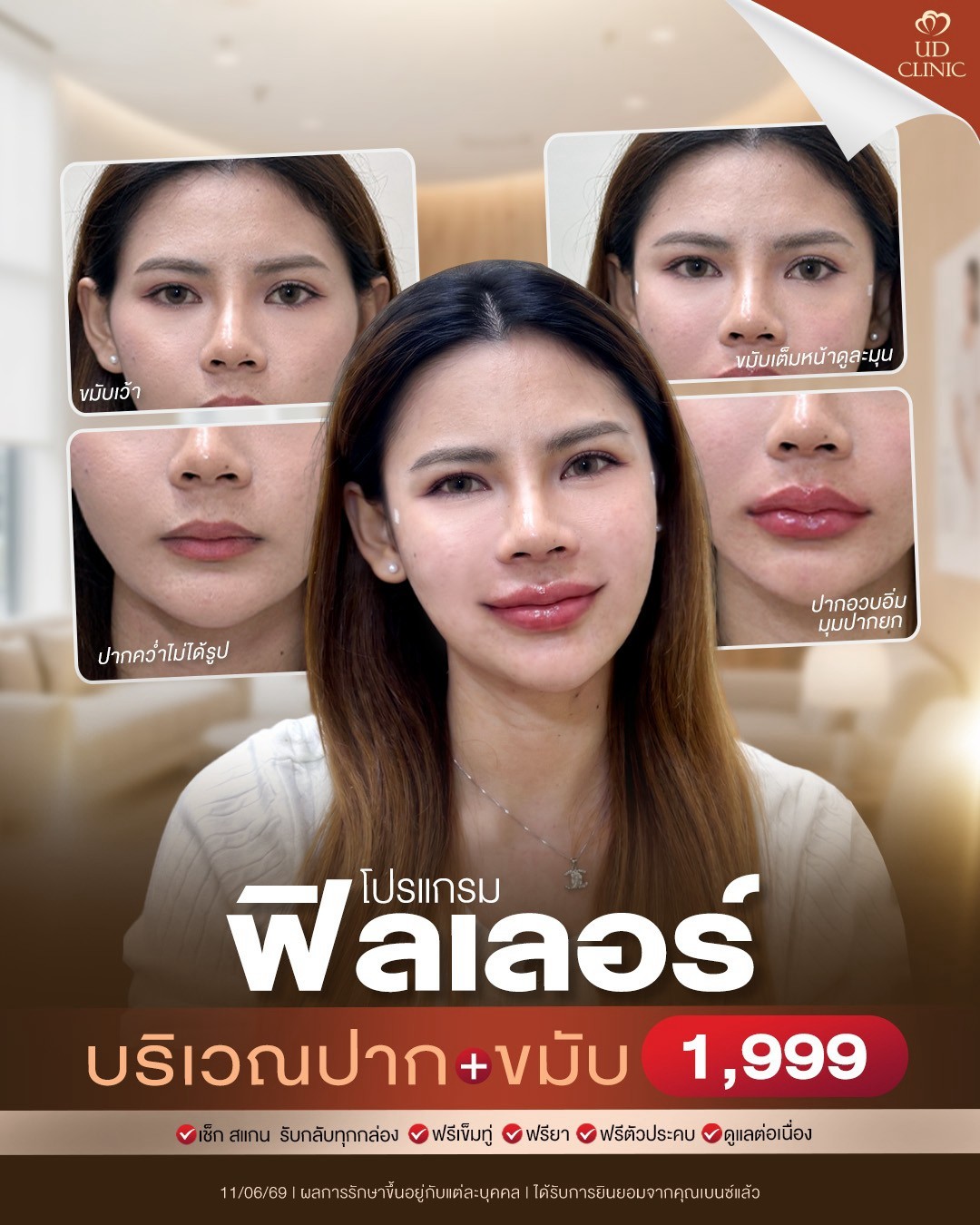 LINE_ALBUM_Skin UD Clinic 3_260905_2