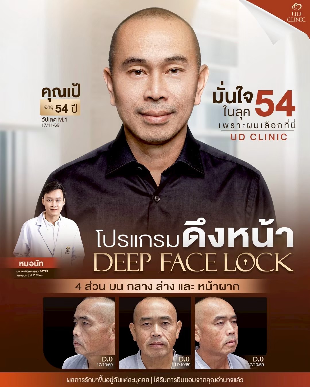 LINE_ALBUM_UD-ศัลยกรรมดึงหน้า 2_260826_1