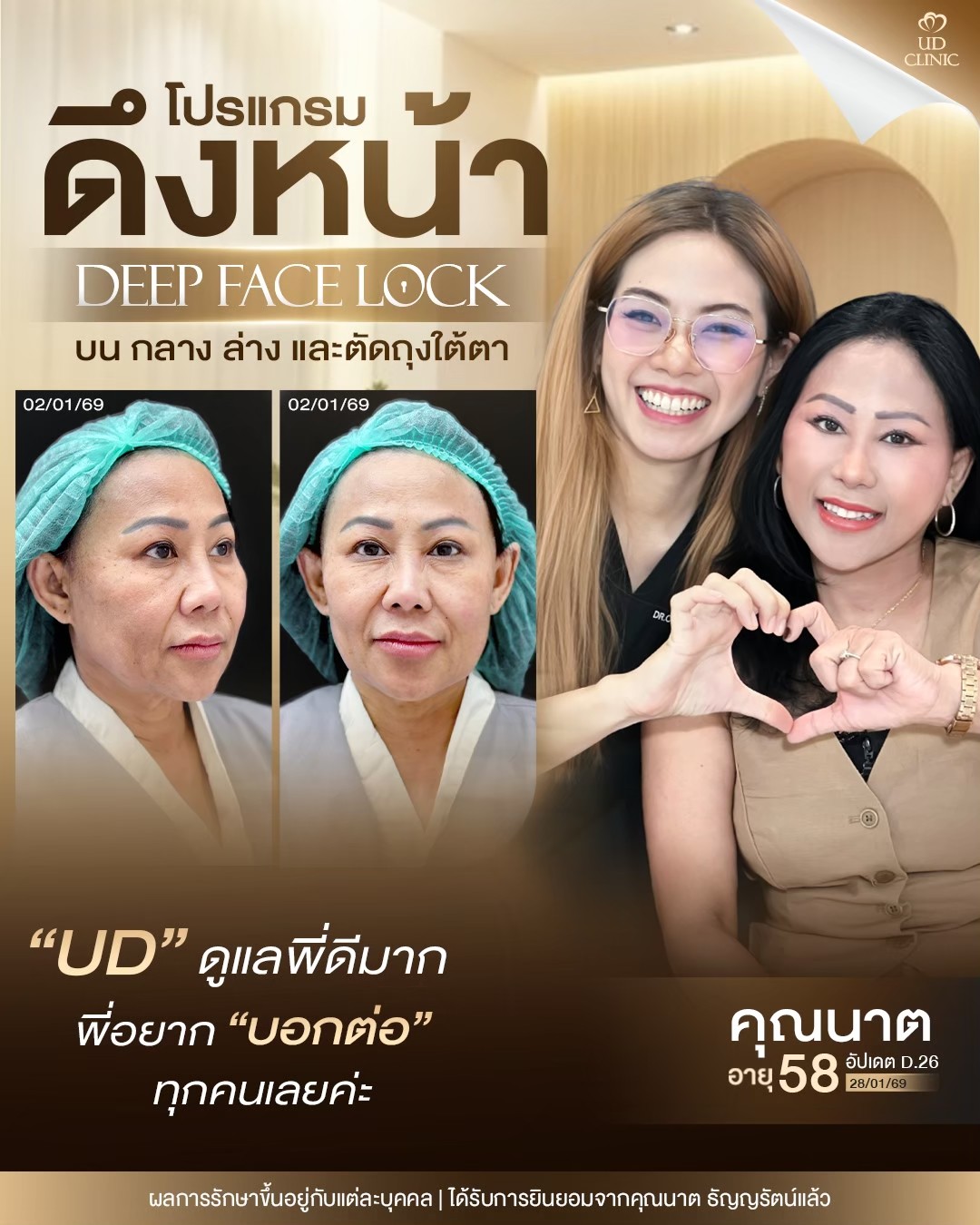 LINE_ALBUM_UD-ศัลยกรรมดึงหน้า 2_260911_2