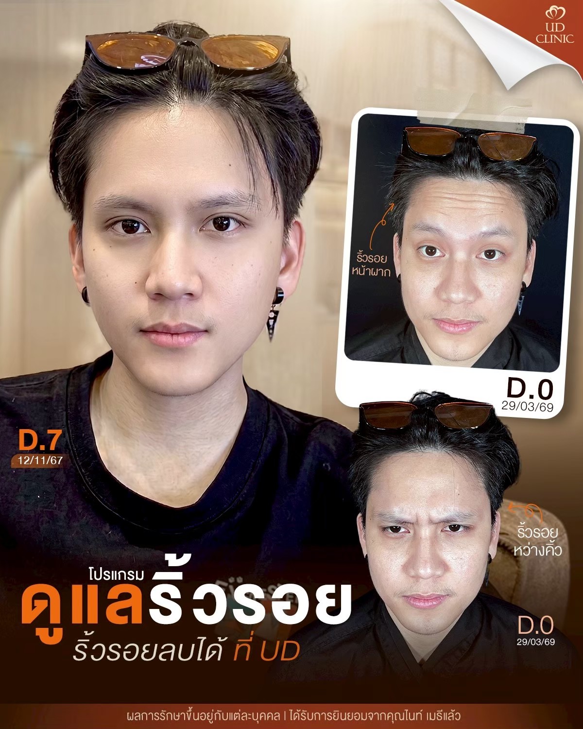 LINE_ALBUM_Skin UD Clinic 2_260909_1