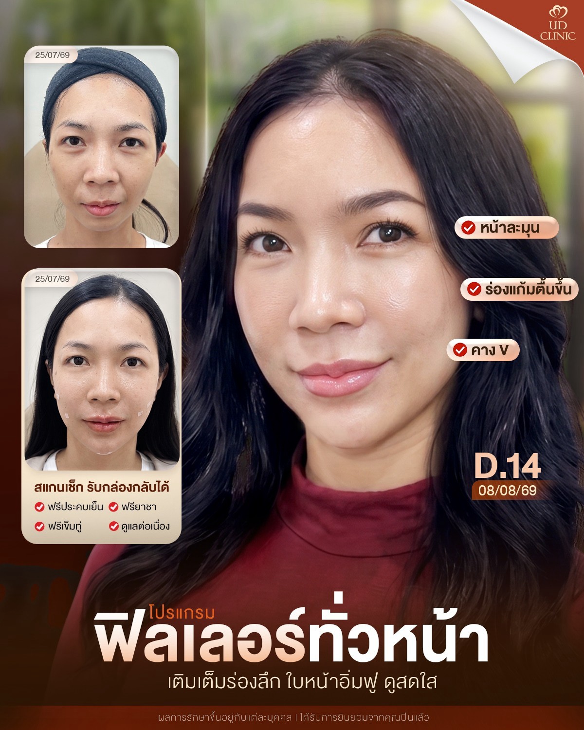 LINE_ALBUM_Skin UD Clinic 3_260905_1