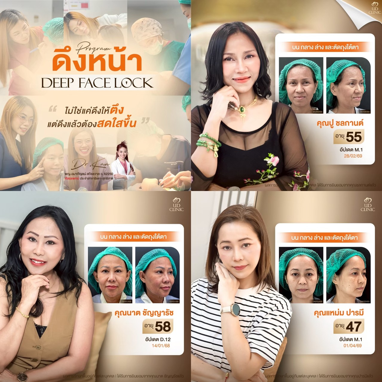 LINE_ALBUM_UD-ศัลยกรรมดึงหน้า 2_260911_1
