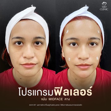 9คุณนิว